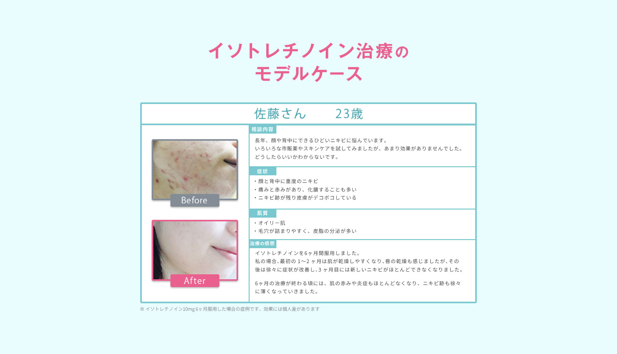 モデルケース｜佐藤さん23歳